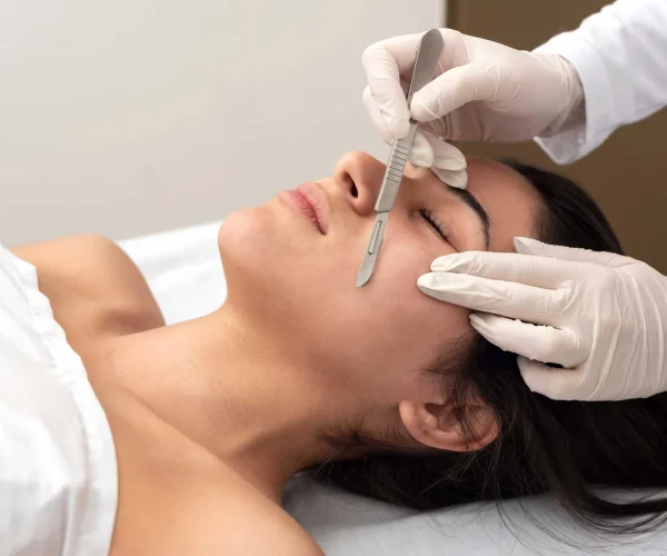 Dermaplaning